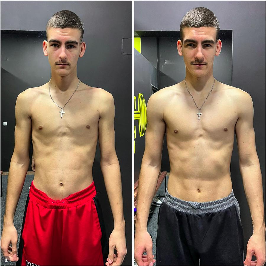 💥Novi rezultat u timu💥 -Slika lijevo 69.5kg. Slika desno 74.8kg. - Napredak klijenta za 30 dana personalnih treninga. U ovih 30 dana dobili smo 5.3kg. Pored kilaže obimi su pratili. - Obim ruke skočio sa 31cm na 34cm. U struku je dobio 3.5cm dok je obim noge skočio sa 50.5cm na 54cm. - Ishrana ispraćena u gram. Makrosi koje smo počeli su 200g protein i 60g mast fiksno držali, uh rotacija 300-250-200. - Kardio treninge nismo radili. - Svaka čast bruda ispoštovao si sve što sam tražio od tebe i rezultat je morao da dođe. Dalje nastavljamo još jače ⏳🦾