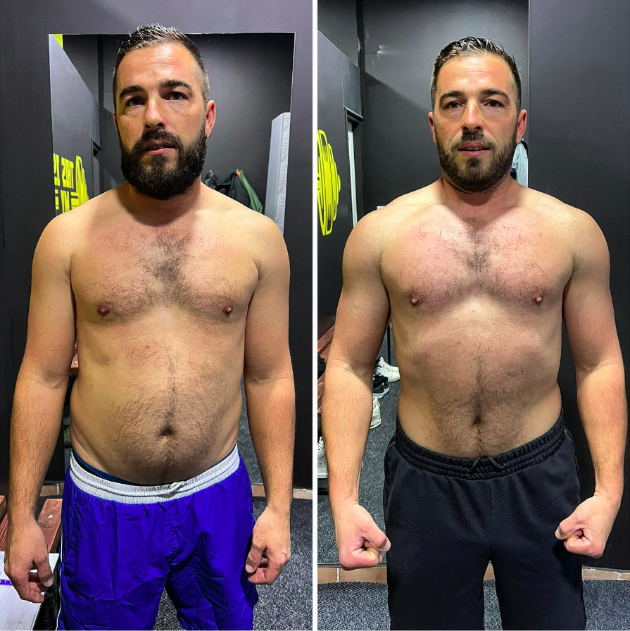 Slika lijevo 83kg. Slika desno 77kg. - Napredak klijenta za 30 dana personalnih treninga. U ovih 30 dana vaga je pokazala 6kg manje. Pored izgubljene kilaže u struku smo istopili 13.5cm. Obim ruke sa 39cm skočio na 41.5cm. Obim noge isti. - Ishrana ispraćena u gram. Makrosi koje smo pratili su 200g proteina i 40g mast fiksno dok nam je rotacija UH bila niska 150-100-50. -Kardio treninge radili posle svakog težinskog treninga 30min. -Svaka čast bruda, moram da te pohvalim da si veliki radnik. Dalje nastavljamo još jače. 👏🏻⏳🦾