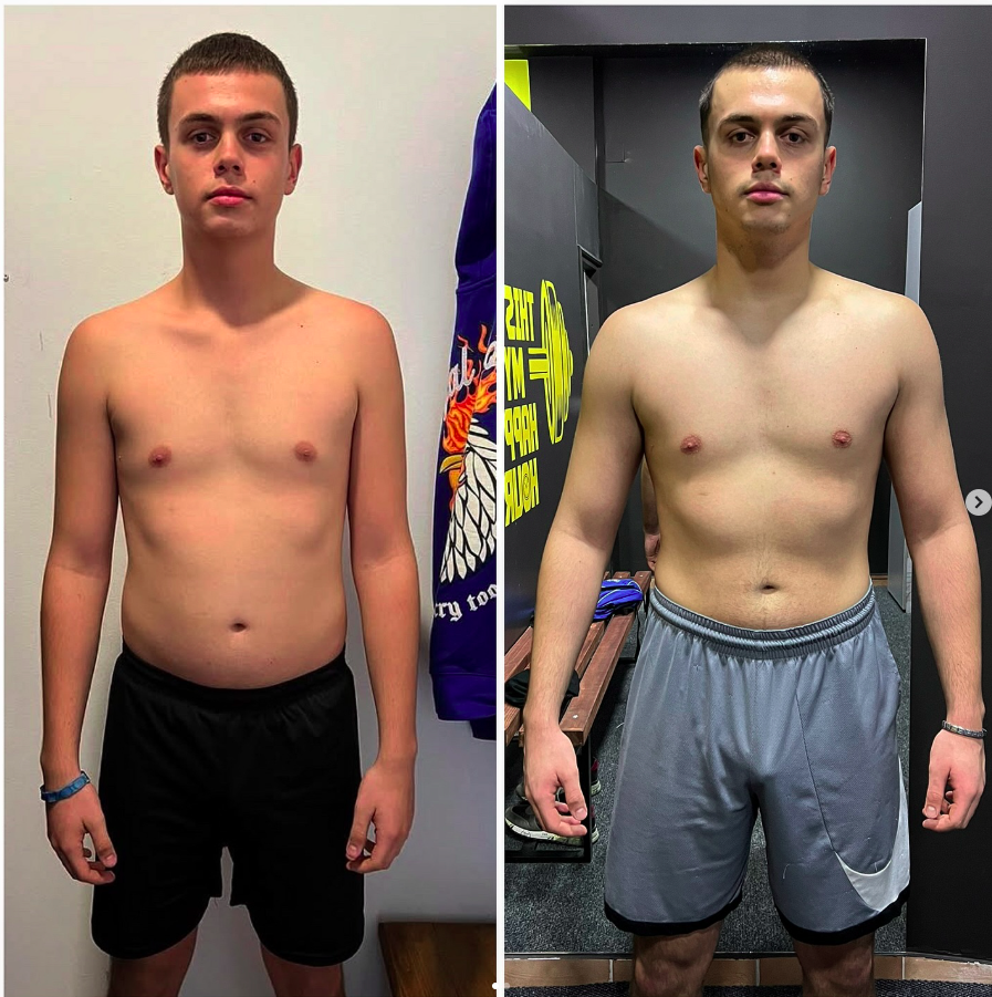 💥Novi rezultat u timu💥 Slika lijevo 75kg. Slika desno 88kg. -Napredak klijenta za 6 mjeseci saradnje. U ovih 6 mjeseci smo dobili 13kg. Pored kilaže obim ruke je sa 33cm skočio na 40.5cm. Obim struka je skočio za 4cm, dok smo u obimu noge dobili 7cm. -Što se tiče ishrane držali smo fiksno 200g protein i 80g mast, hidrate smo rotirali (450-400-350). -Kardio treninge smo radili 2x sedmično po 30min. -Svaka čast bruda, dalje idemo još jače. 🦾📈⏳
